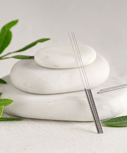 Acupuncture and Functional Medicine at Advanced Wellness Center in Woodridge, IL